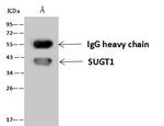 SUGT1 Antibody in Immunoprecipitation (IP)