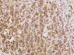 SULT2A1 Antibody in Immunohistochemistry (Paraffin) (IHC (P))
