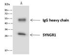 SYNGR1 Antibody in Immunoprecipitation (IP)