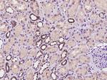 SYT12 Polyclonal Antibody