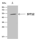 SYT12 Antibody in Immunoprecipitation (IP)