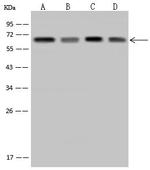 TAB1 Polyclonal Antibody