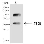 CKAP1 Antibody in Immunoprecipitation (IP)