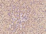TBCE Polyclonal Antibody