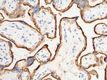 Transferrin Receptor Antibody in Immunohistochemistry (Paraffin) (IHC (P))