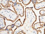 Transferrin Receptor Antibody in Immunohistochemistry (Paraffin) (IHC (P))