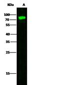 Transferrin Receptor Antibody in Western Blot (WB)