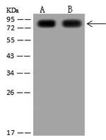 TGM2 Polyclonal Antibody