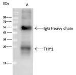 CD90 Antibody in Immunoprecipitation (IP)
