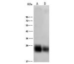 CD90 Antibody in Western Blot (WB)