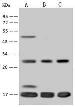 TIM17 Polyclonal Antibody