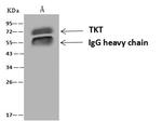 Transketolase Antibody in Immunoprecipitation (IP)