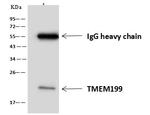 TMEM199 Antibody in Immunoprecipitation (IP)