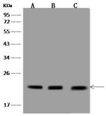 TMEM199 Polyclonal Antibody