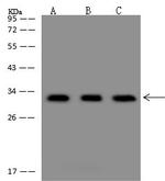 TMEM255B Antibody in Western Blot (WB)