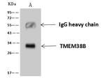 TMEM38B Antibody in Immunoprecipitation (IP)