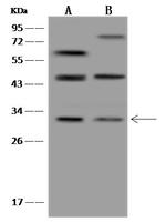 TMEM38B Antibody in Western Blot (WB)