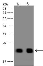 TMEM92 Polyclonal Antibody