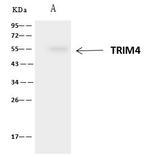 TRIM4 Antibody in Immunoprecipitation (IP)