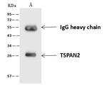 TSPAN2 Antibody in Immunoprecipitation (IP)