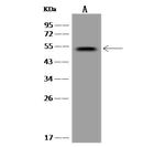 TTC23 Polyclonal Antibody