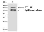 TTLL12 Antibody in Immunoprecipitation (IP)