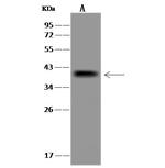 UBE2J1 Polyclonal Antibody