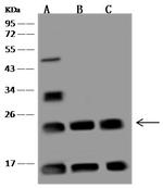 UBE2T Polyclonal Antibody