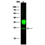 PGP9.5 Polyclonal Antibody