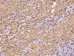 UEVLD Polyclonal Antibody