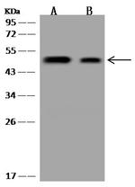 UEVLD Antibody in Western Blot (WB)