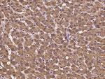 UGP2 Polyclonal Antibody