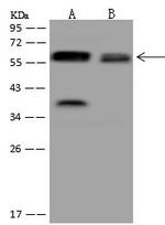 UGT8 Polyclonal Antibody