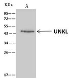 UNKL Antibody in Immunoprecipitation (IP)