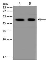 UNKL Antibody in Western Blot (WB)