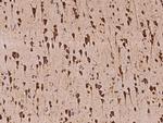 VARS Antibody in Immunohistochemistry (Paraffin) (IHC (P))