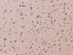 CCDC132 Polyclonal Antibody
