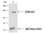 CCDC132 Antibody in Immunoprecipitation (IP)