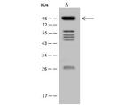 VPS53 Polyclonal Antibody