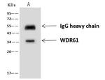 WDR61 Antibody in Immunoprecipitation (IP)