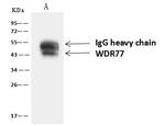 WDR77 Antibody in Immunoprecipitation (IP)