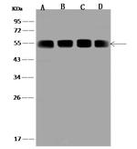 XIAP Polyclonal Antibody
