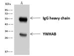 14-3-3 beta Antibody in Immunoprecipitation (IP)