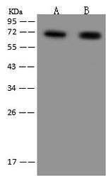 ZNF192 Antibody in Western Blot (WB)