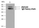 ZNF143 Antibody in Immunoprecipitation (IP)