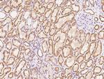 ZNF234 Polyclonal Antibody