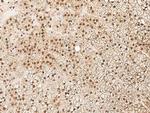 ZNF346 Antibody in Immunohistochemistry (Paraffin) (IHC (P))