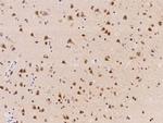 ZNF346 Antibody in Immunohistochemistry (Paraffin) (IHC (P))