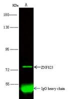ZNF823 Antibody in Immunoprecipitation (IP)