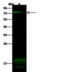 ZNF823 Antibody in Western Blot (WB)